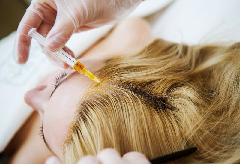 Mesotherapie haar