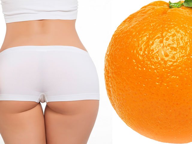 Méthodes pour se débarrasser de la cellulite