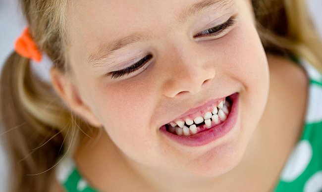 Comment parler un mal de dents?