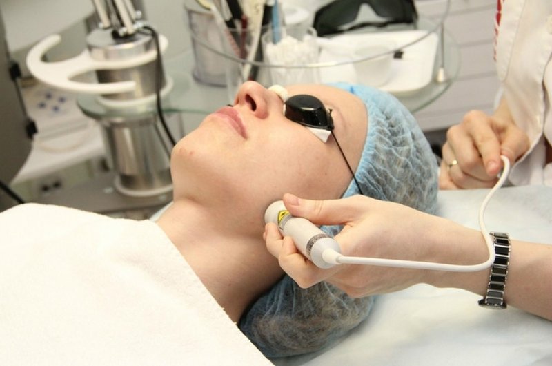 Procedura de biorevitalizare cu laser