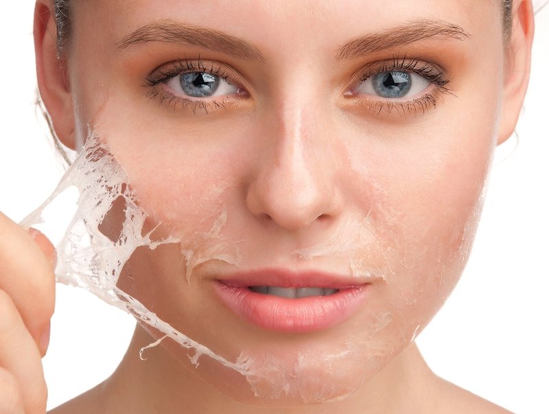 Wat is de procedure voor PQ AGE peeling?